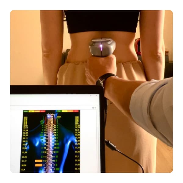 Thermo Scan